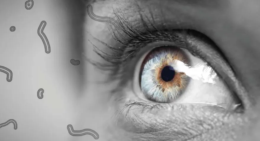 What are Eye Floaters