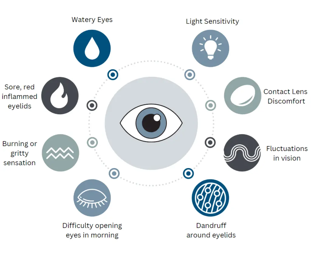 An illustrative diagram of common symptoms of eye discomfort, including tearing, redness and swelling, light sensitivity, fluctuating vision, and a foreign body sensation.